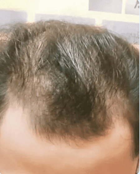 testimony photo before