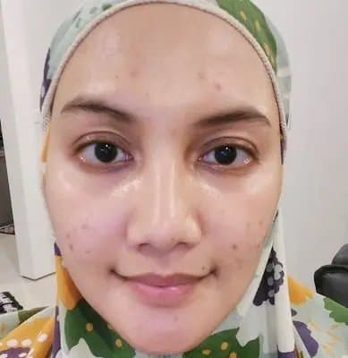 testimony photo after