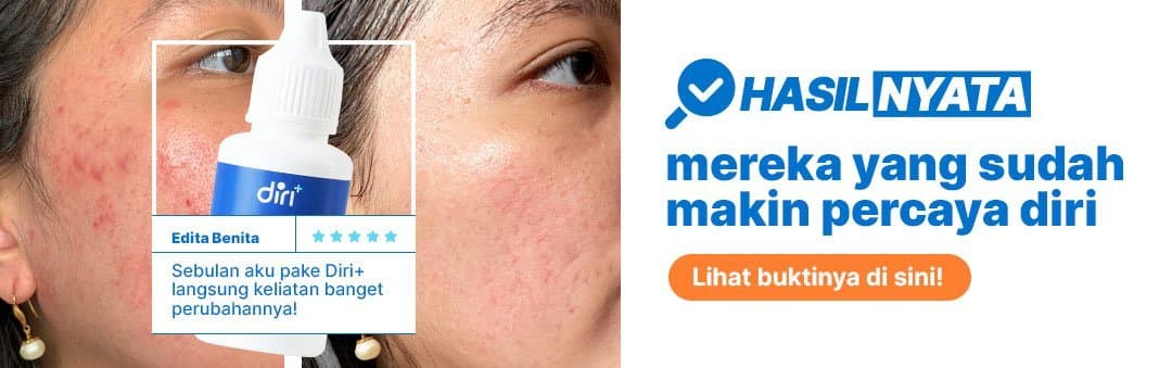 Temukan Diri Clinic di dekat Anda! Sanity 10 Nov
